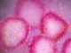 Coronavirus confirmed in U.S.; ADPH joins with CDC, others to prevent spread