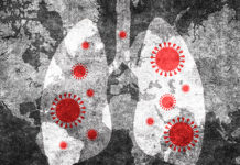 UAB among 1st in U.S. to offer clinical trial for the treatment of patients with severe COVID-19 using nitric oxide