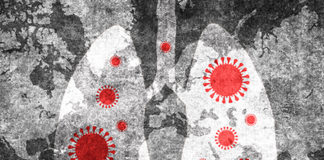 UAB among 1st in U.S. to offer clinical trial for the treatment of patients with severe COVID-19 using nitric oxide