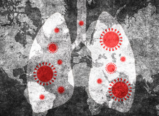 UAB among 1st in U.S. to offer clinical trial for the treatment of patients with severe COVID-19 using nitric oxide