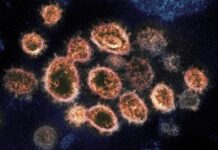 ADPH: B.1.1.7 (U.K.) COVID-19 variant identified in 8 Alabama residents