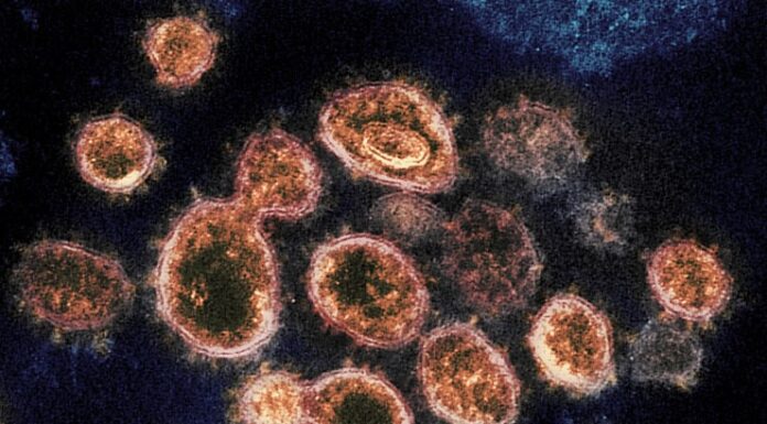 ADPH: B.1.1.7 (U.K.) COVID-19 variant identified in 8 Alabama residents