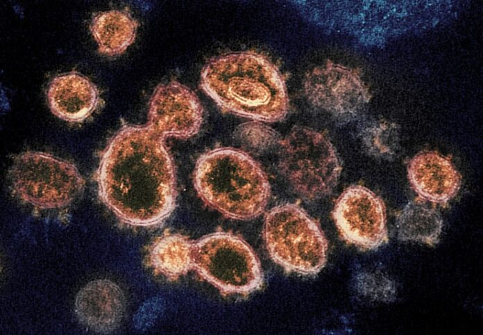 sars-cov-2_micro-niaid