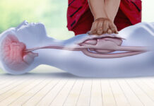 Save a life by getting CPR certified