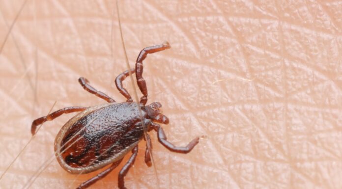 ACES: Watch out for ticks; treat them right