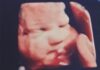Local mother travels to Texas to seek care for unborn baby