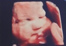 Local mother travels to Texas to seek care for unborn baby