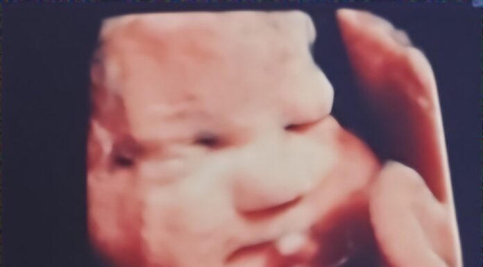 Local mother travels to Texas to seek care for unborn baby