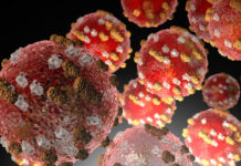 ADPH announces first case of measles in Alabama since 2002