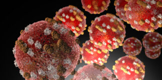 ADPH announces first case of measles in Alabama since 2002