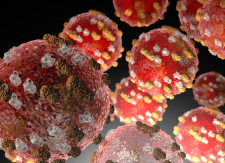 ADPH announces first case of measles in Alabama since 2002