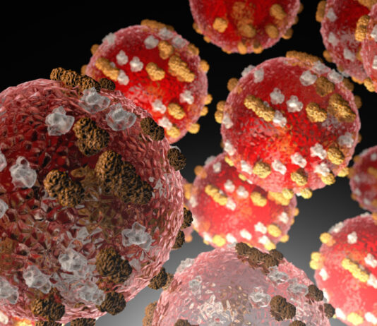 ADPH announces first case of measles in Alabama since 2002