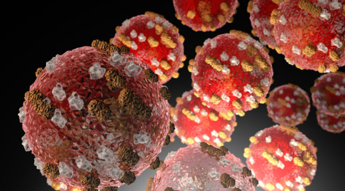 ADPH announces first case of measles in Alabama since 2002