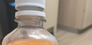 Op-Ed: The 1-hour glucose test
