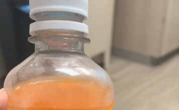 Op-Ed: The 1-hour glucose test Â