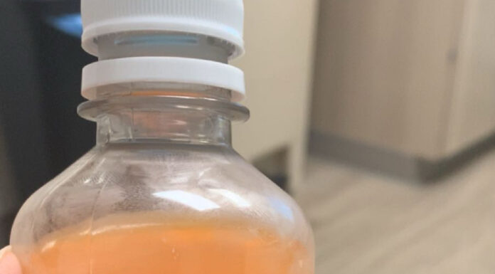 Op-Ed: The 1-hour glucose test