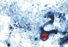 Cyclospora cases emphasize the need for food safety