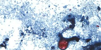 Cyclospora cases emphasize the need for food safety Â