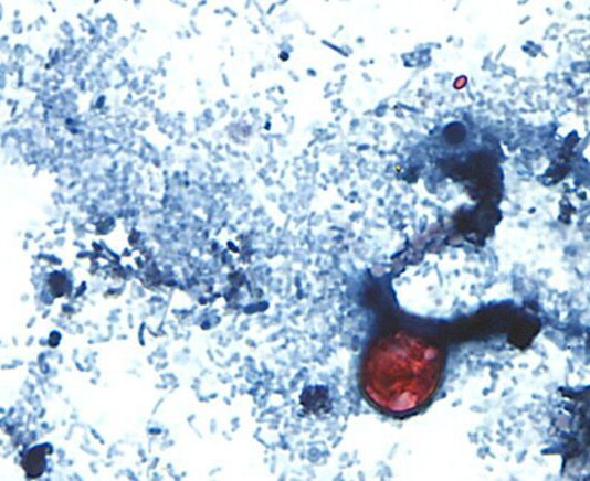 Cyclospora cases emphasize the need for food safety