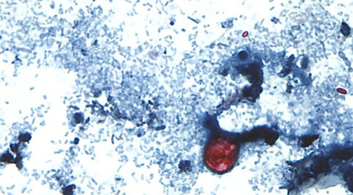 Cyclospora cases emphasize the need for food safety